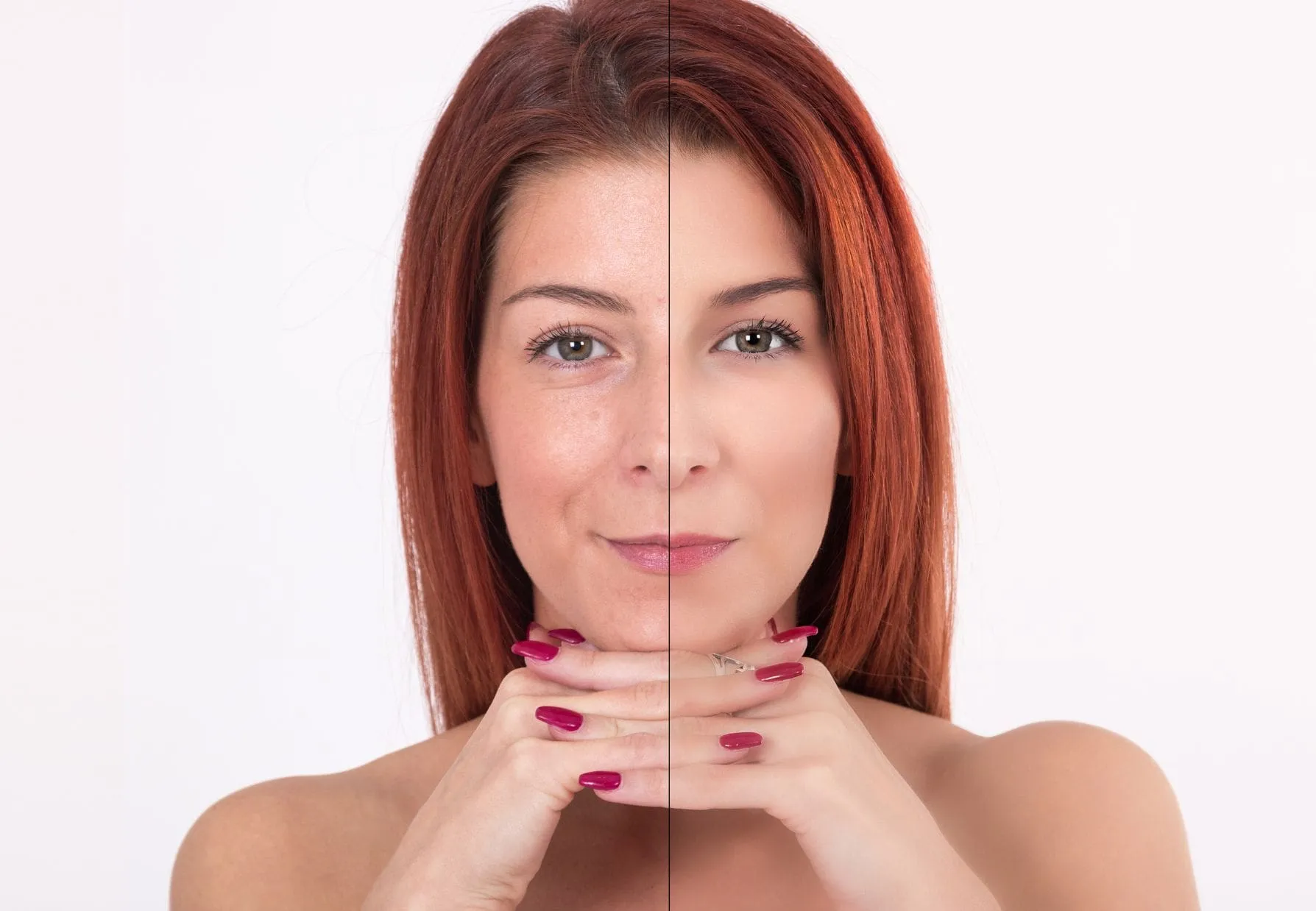 Armonización Facial